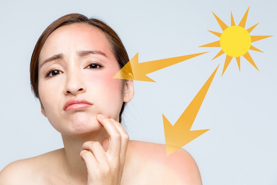 夏に向けて「紫外線対策」　3つのポイントで紫外線から肌や髪を守ろう。