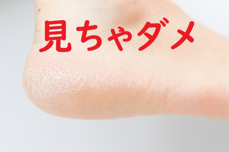 かかとガサガサ