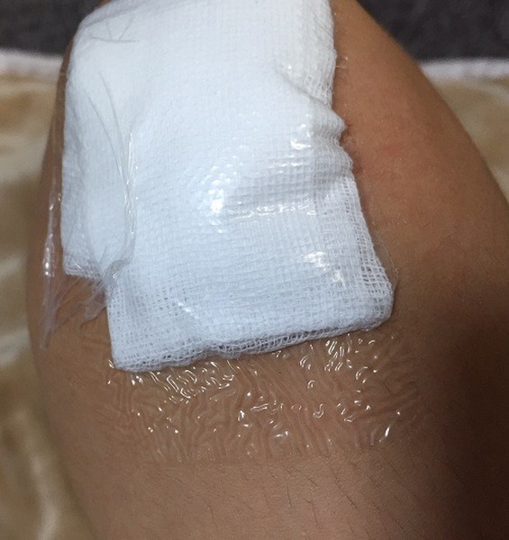 夏に役立つ100均グッズ4選　「100均にもあったのか」と後悔しないよう、まずは100均を覗いてみる。