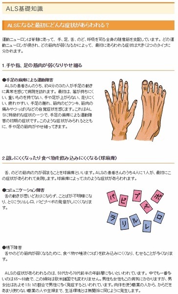 ALSの症状とは