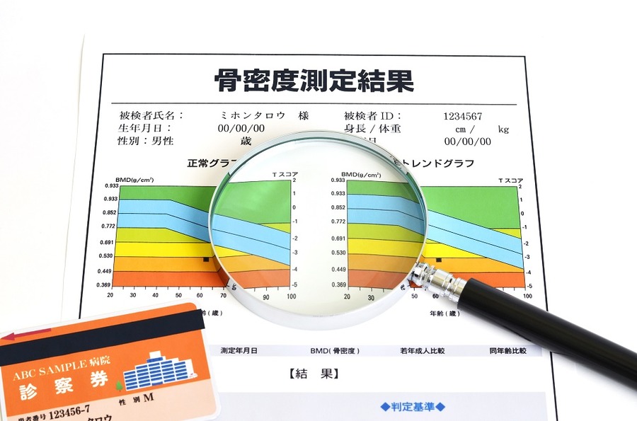 骨粗鬆症検診