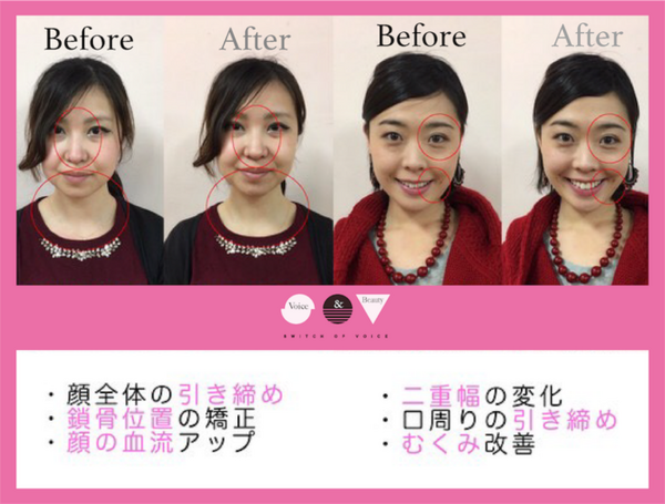 ボイトレレッスンビフォーアフター