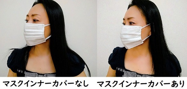 見た目の違和感はなし