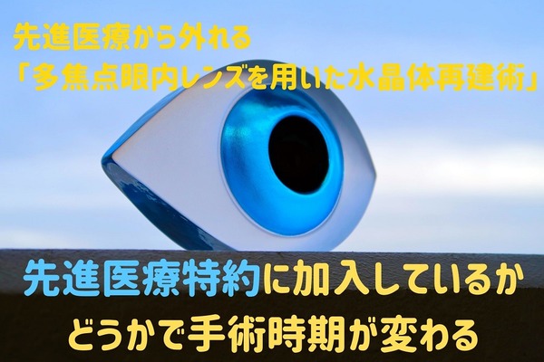 【白内障・老眼治療】=「多焦点眼内レンズを用いた水晶体再建術」は「医療特約」加入なら3月末までに受ける、未加入なら4月以降がメリット大 画像