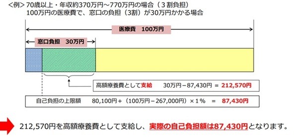 70歳以上・年収約370～770万円蔓延の場合の自己負担額計算例の図